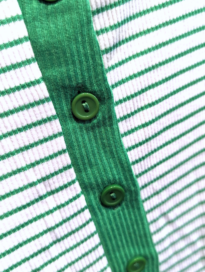 detail shot of the button front of the stripe minidress